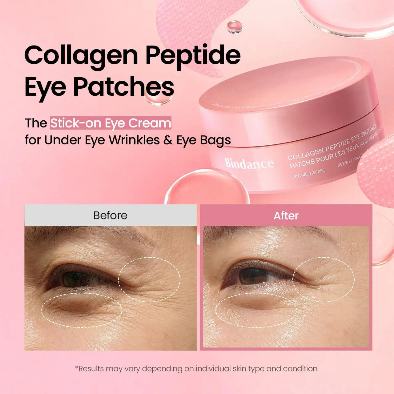 [Biodance Official] Collagen Peptide Eye Patch | anti Wrinkle Patches for Face & Smile Line Patches, under Eye Mask for Fine Lines, Eye Bags & Wrinkles, Korean Skin Care (60Ea)
