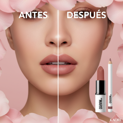 Lip Lift Kit - Antes y Después